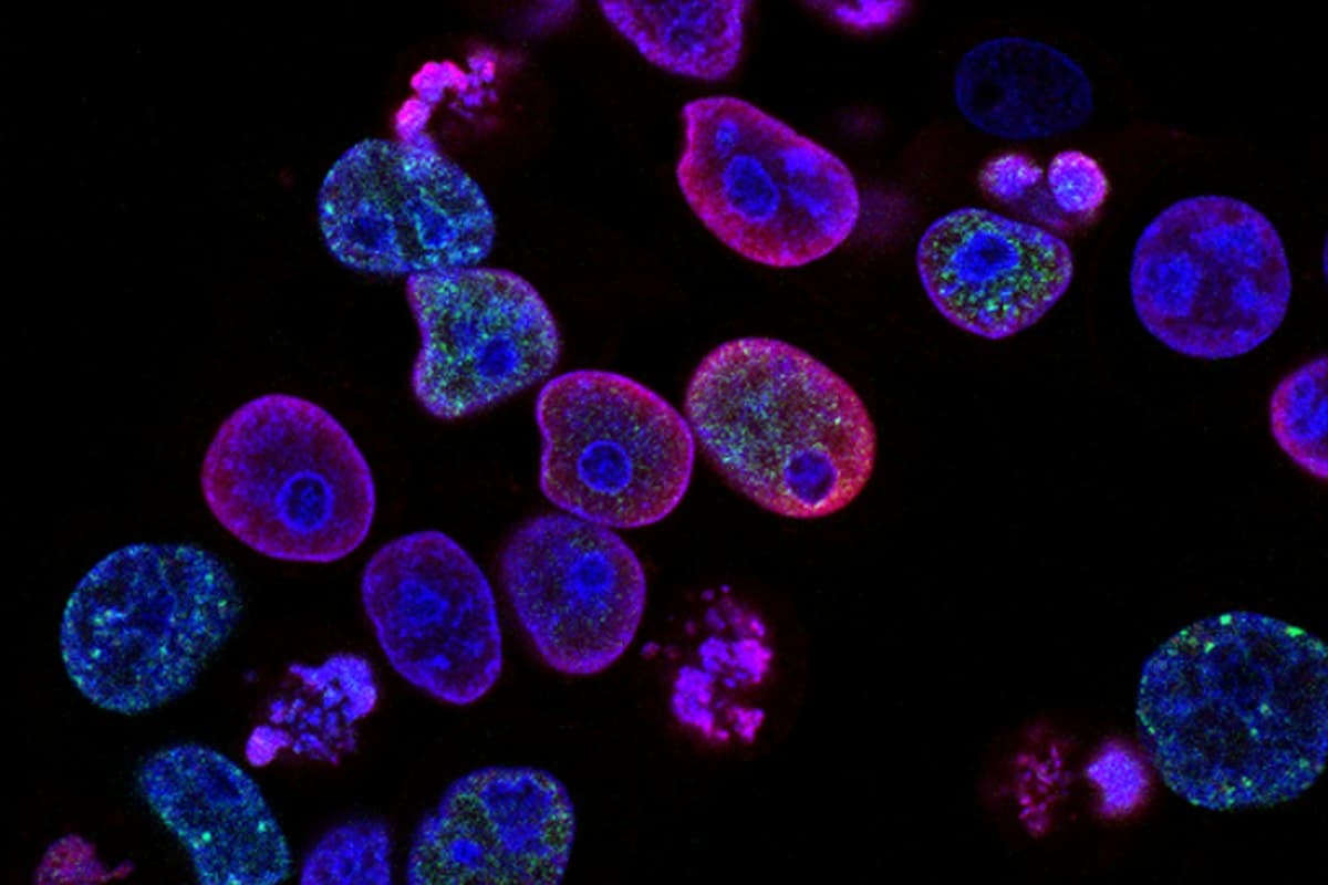 SS-31 Is an Approved Drug Now. Just Not for What It Is Sold For.